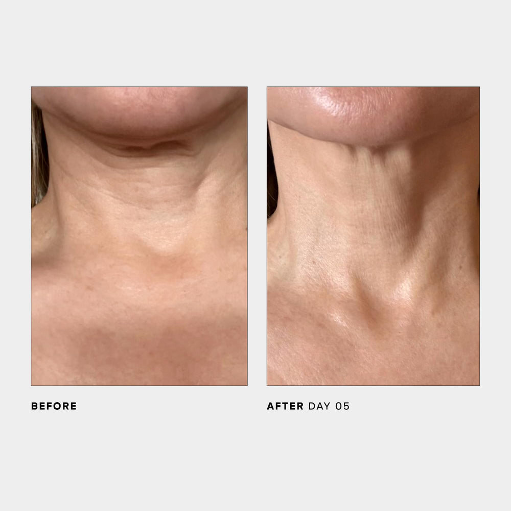 U Beauty SCULPT: vitaminas C y E estabilizadas para luminosidad suave.