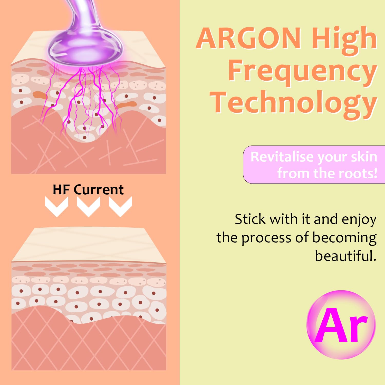 Uaike tubo champiñón de alta frecuencia facilita tratamientos puntuales.