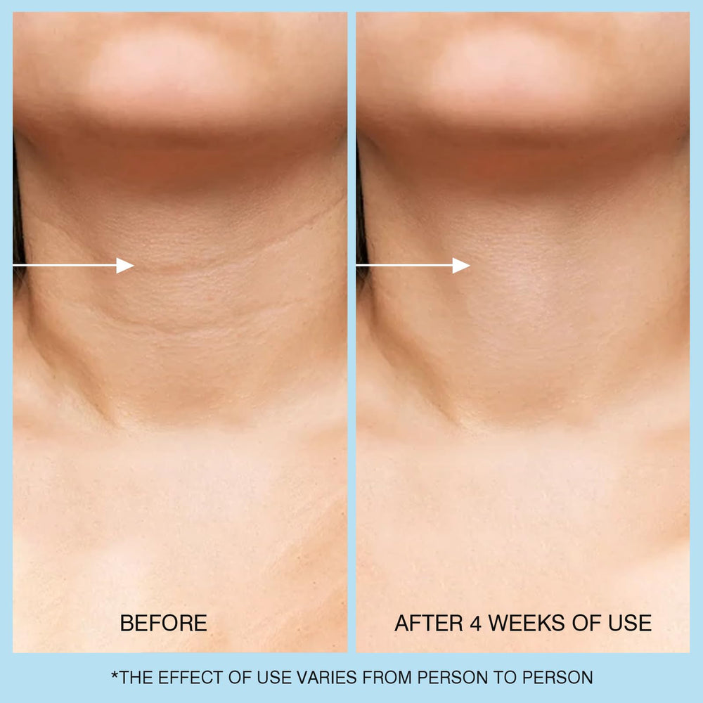 UJHAY Crema de Cuello con vitamina C: tono más uniforme y luminoso.