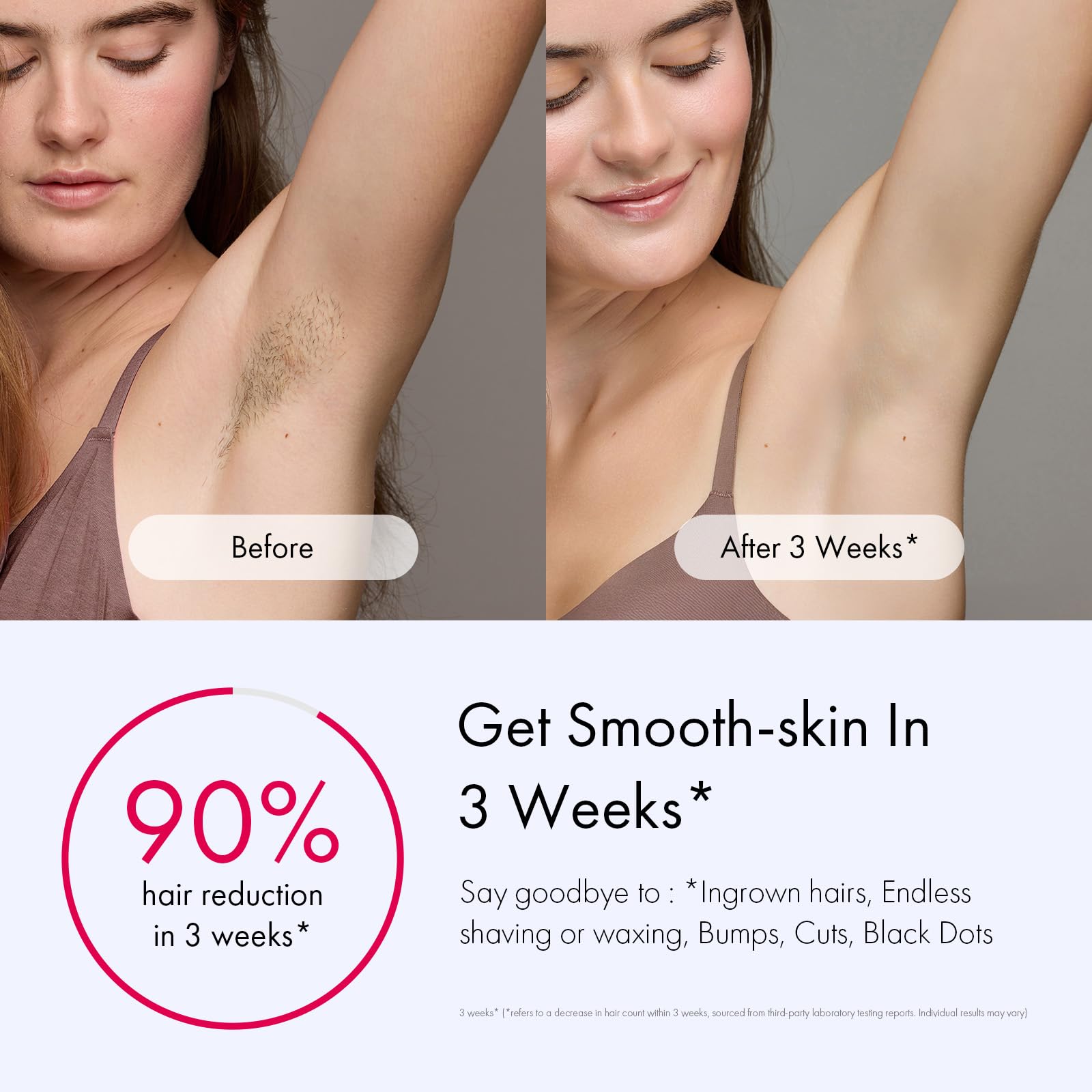 Dispositivo IPL de Ulike para uso rápido en cuerpo completo.