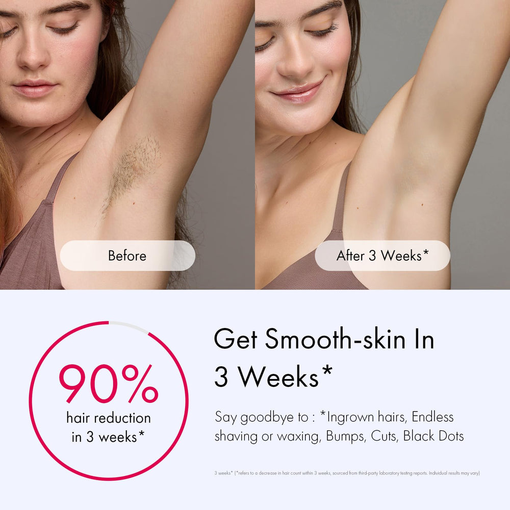 Dispositivo IPL de Ulike para uso rápido en cuerpo completo.