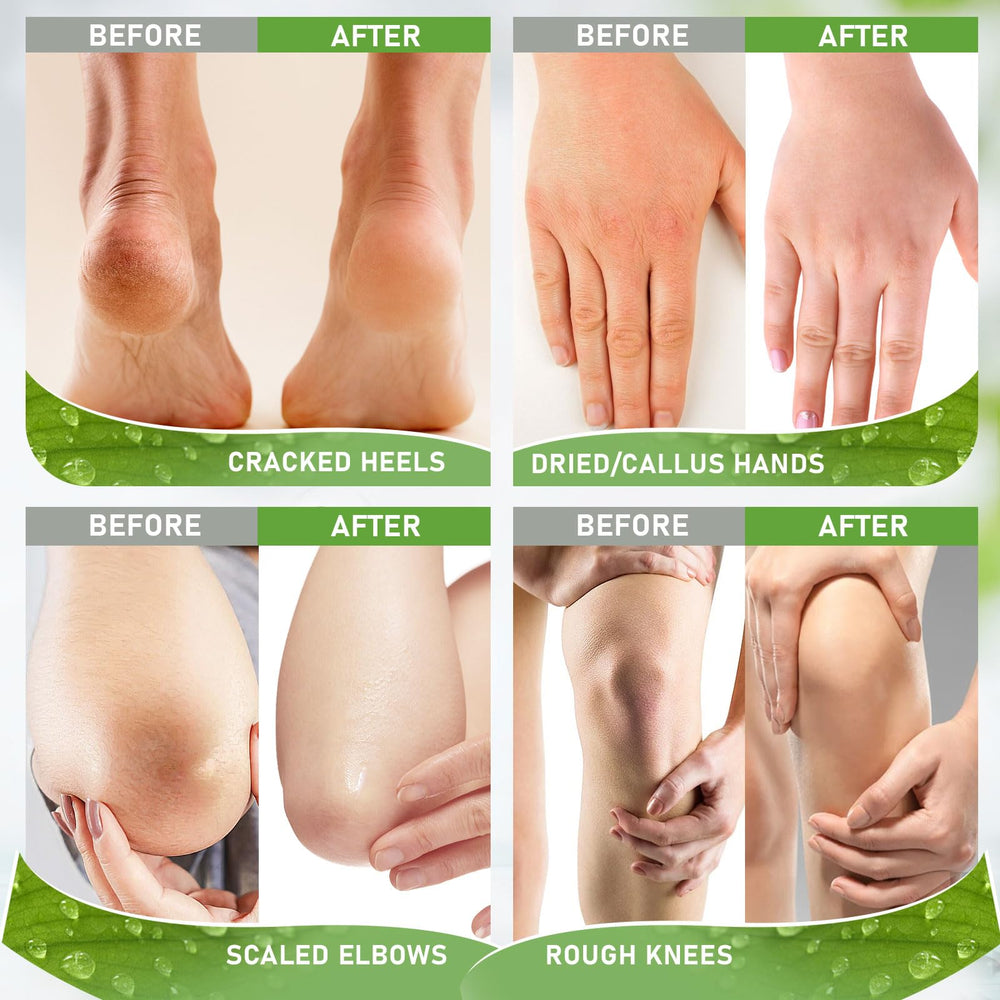 Envase de Ultrove con ingredientes naturales.