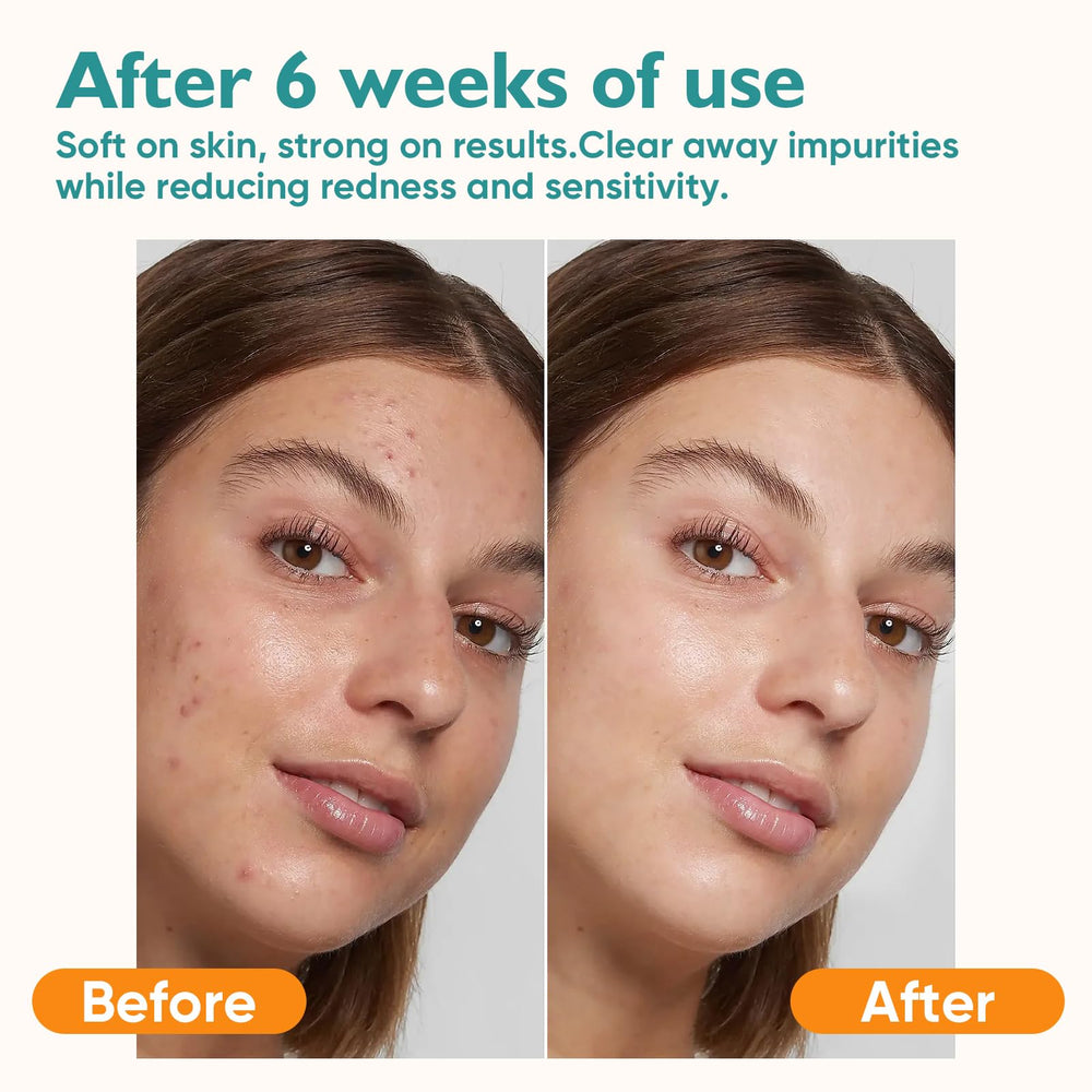 UNIMADE: toallitas faciales sin fragancia, aptas para piel sensible.