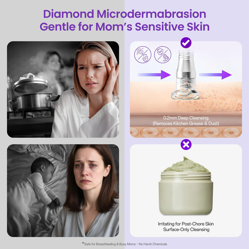 UNOISETION Diamond Microdermabrasion, kit todo en uno con cabezales de diamante para piel suave