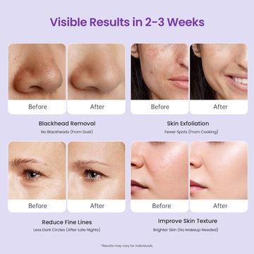 UNOISETION Diamond Microdermabrasion, instrucciones en inglés disponibles en el manual incluido