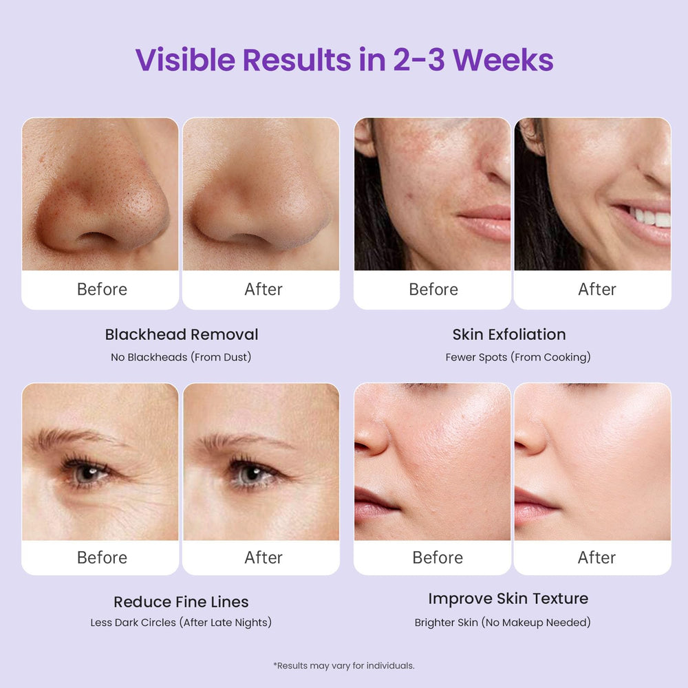 UNOISETION Diamond Microdermabrasion, instrucciones en inglés disponibles en el manual incluido