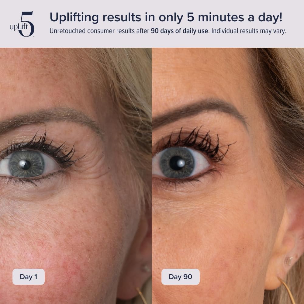 upLift 5: uso diario para contorno facial con mejoras visibles en semanas.
