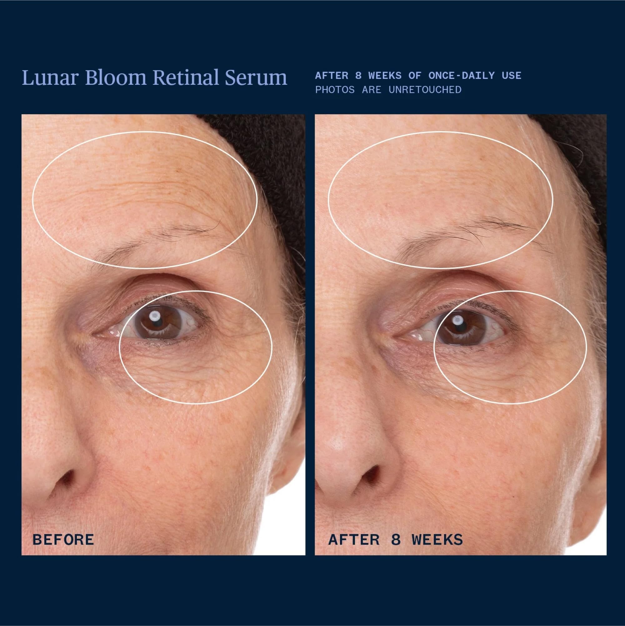 Ursa Major Lunar Bloom Serum, uso nocturno para piel sensible y calmada.