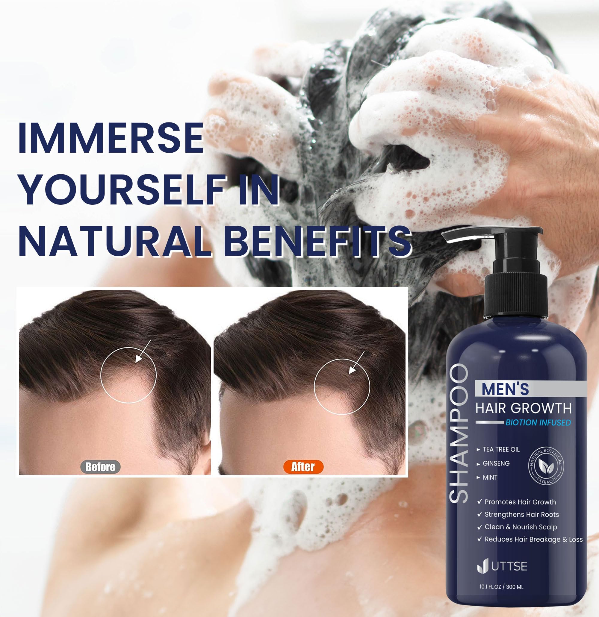 Uttse Biotion Shampoo regalo ideal para hombres con caída.