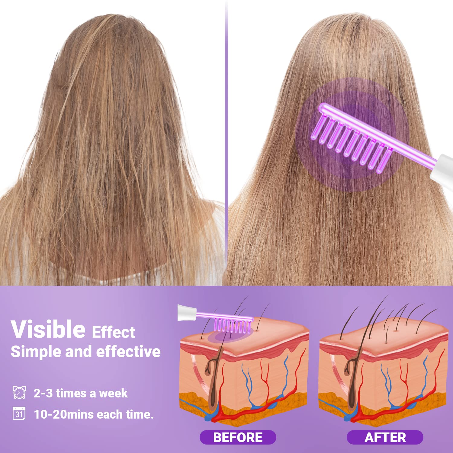 Accesorios tubos de vidrio de la varita UUPAS para tratamientos.