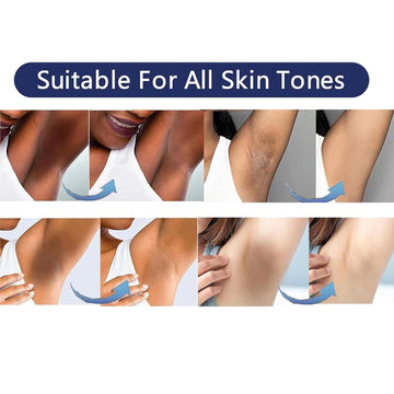 VCETREE crema para muslos internos, tono equilibrado y apariencia uniforme.