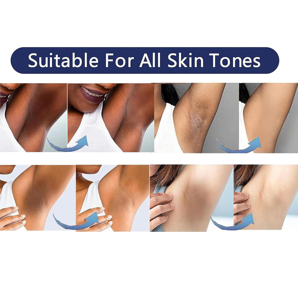 VCETREE crema para muslos internos, tono equilibrado y apariencia uniforme.