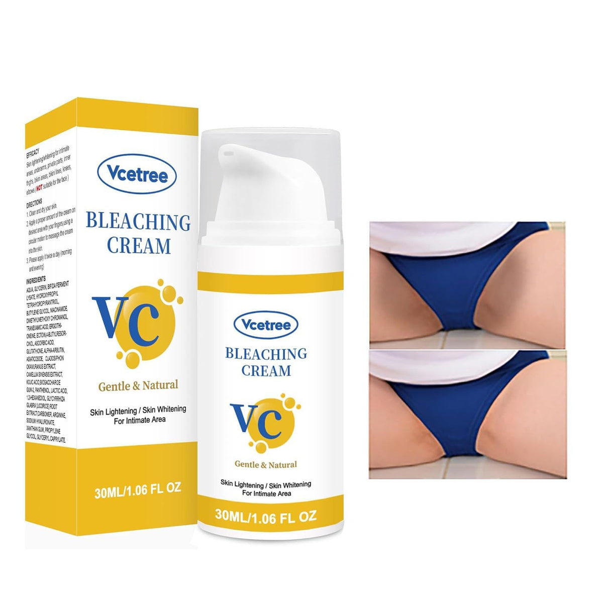 VCETREE crema blanqueadora para zonas íntimas, uso diario suave para piel sensible.