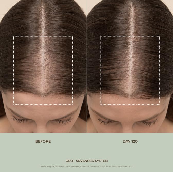 Aplicación diaria de GRO+ Serum sobre el cuero cabelludo para cuidado constante.