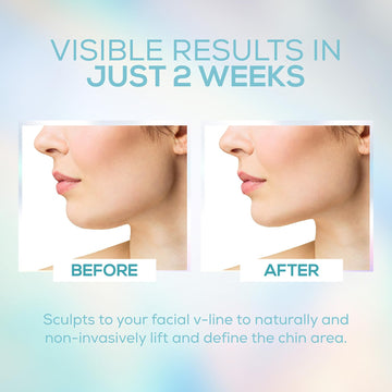 Venus Visage correa ajustable, define la linea mandibula