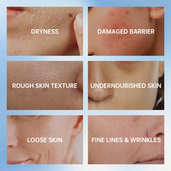 VGO ceramides image focusing on barrier support for calm, hydrated skin.