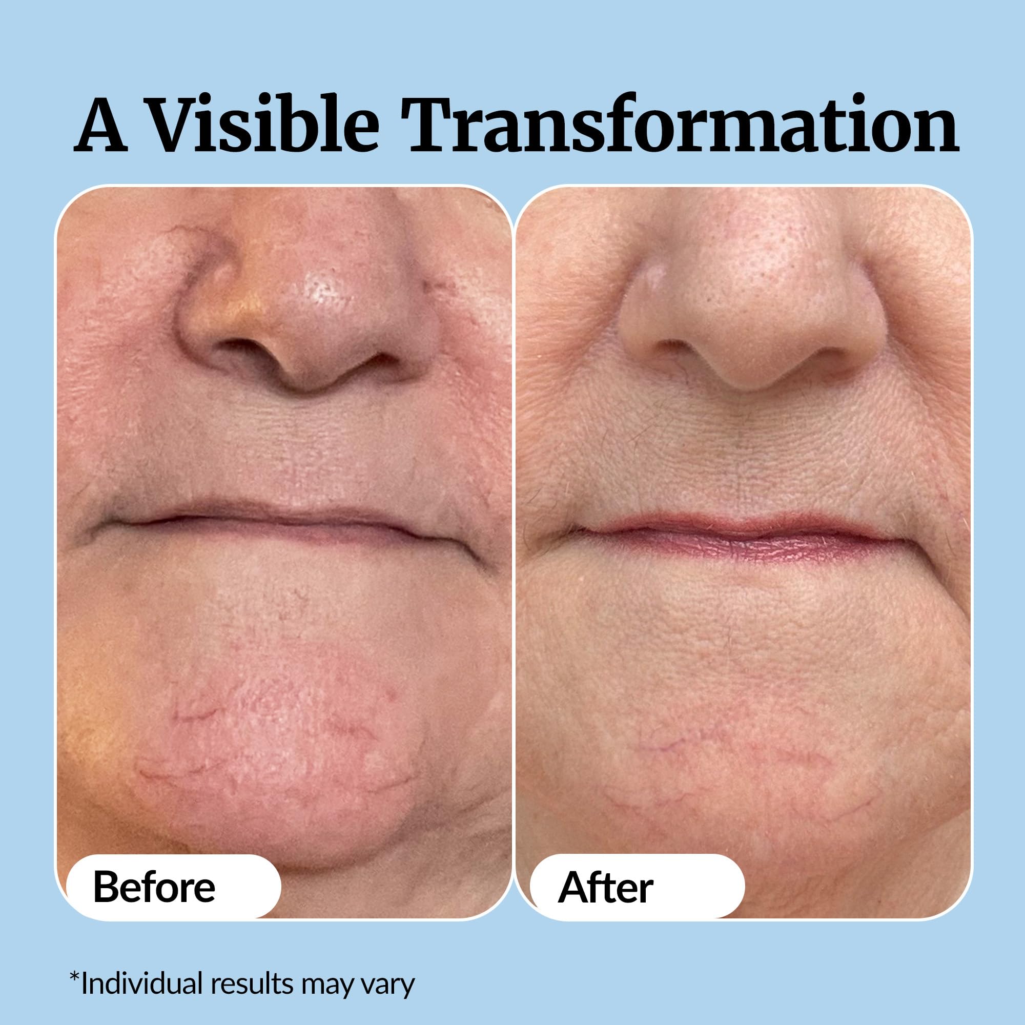 Apertura del frasco de Vibriance Super C Serum listo para usar.