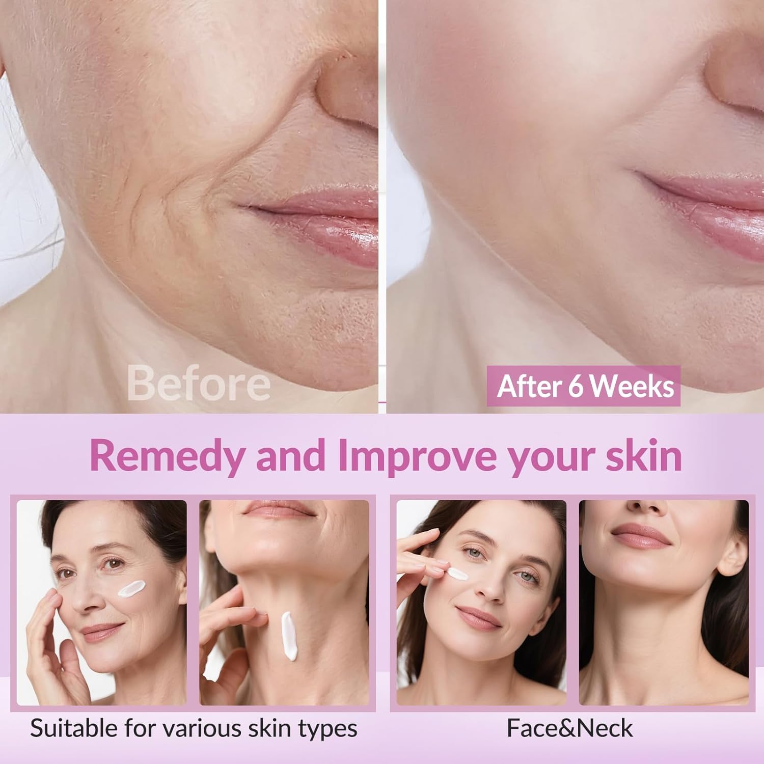 VicGFHS crema cuello-reafirmante mejora el contorno y la firmeza.