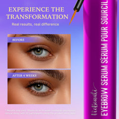 VieBeauti lash serum brush-tip for precise, easy nightly application.
