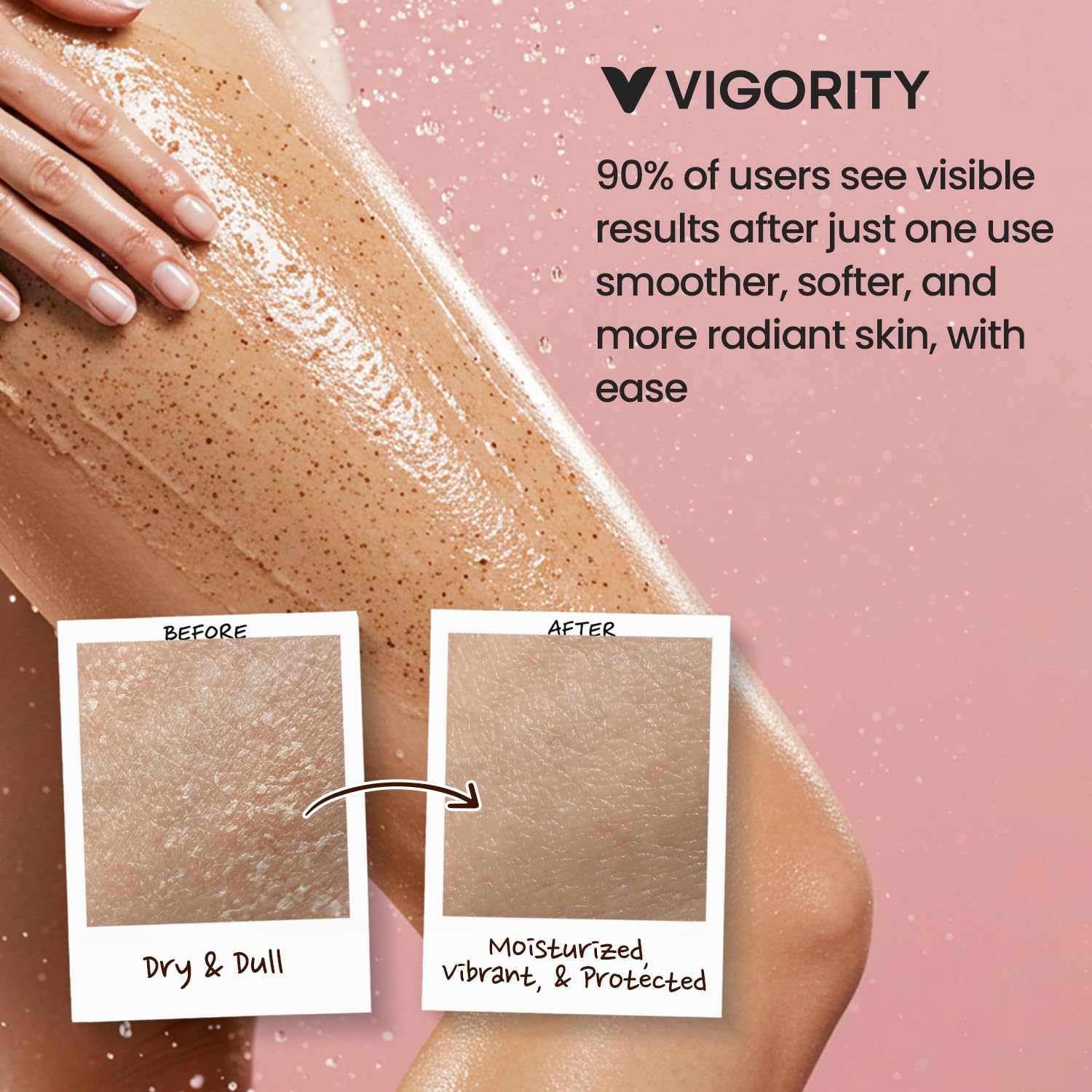 Vigority KP Bump Eraser uso en área bikini para piel limpia