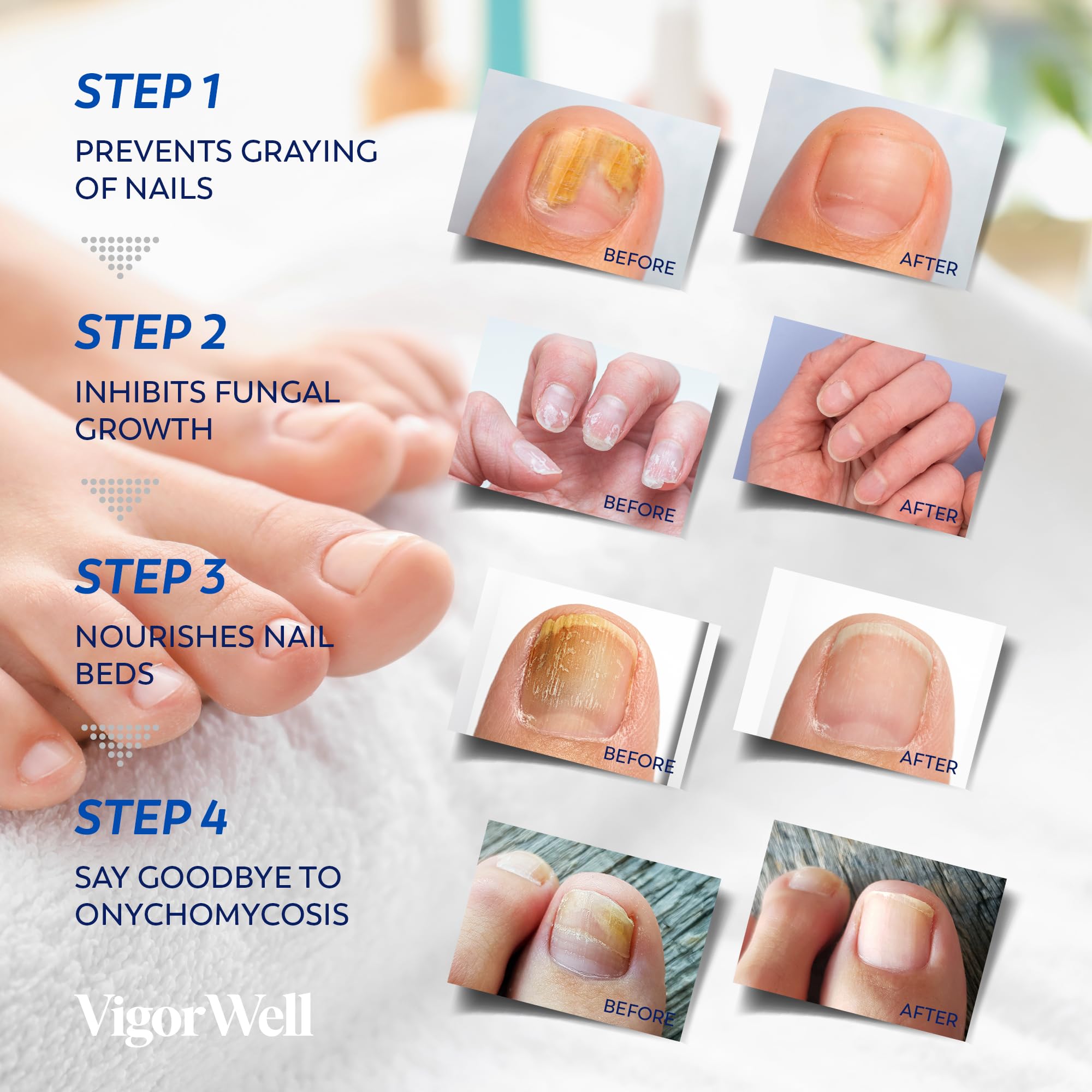 Parches de uñas VigorWell, reparación de uñas en 8 horas.
