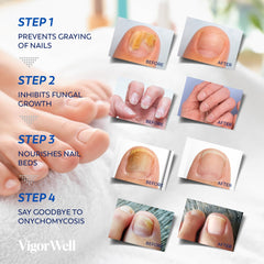 Parches de uñas VigorWell, reparación de uñas en 8 horas.