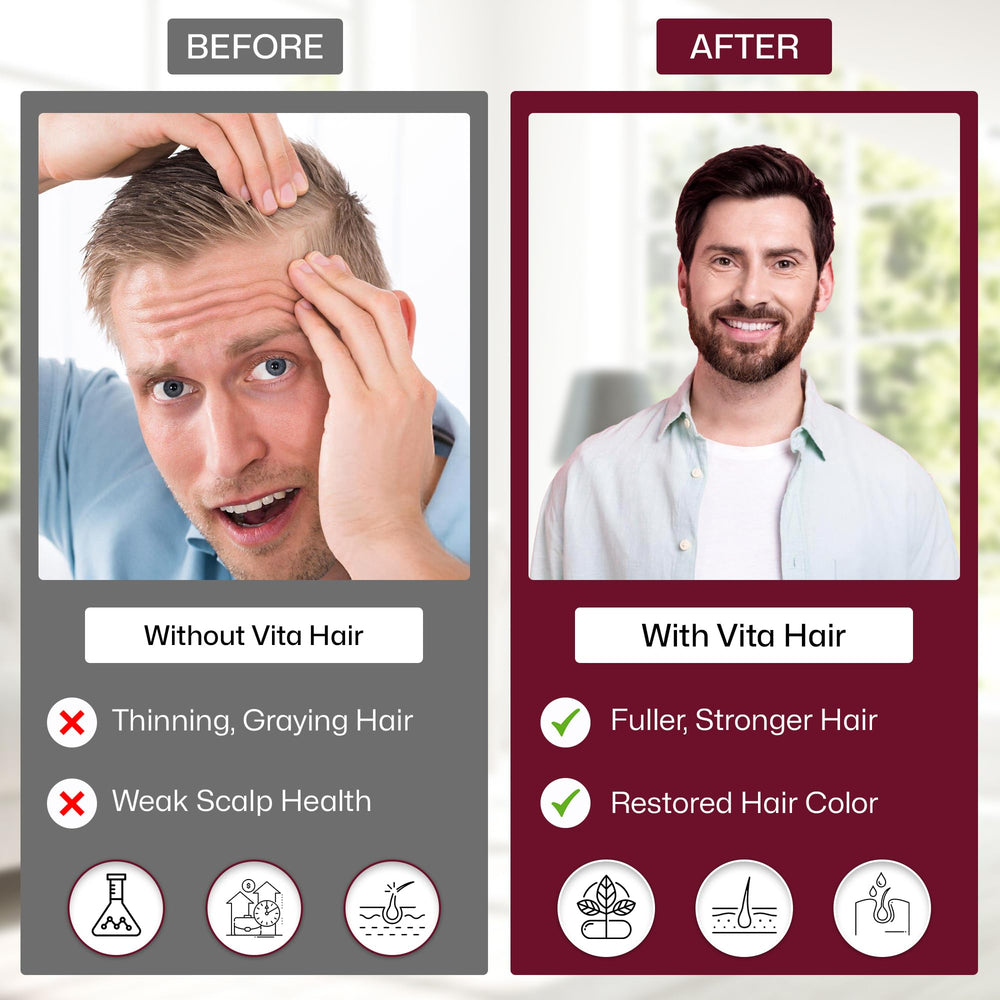 Vita Green Hair Growth Supplement: produit prêt à être posé dans la salle de bains.