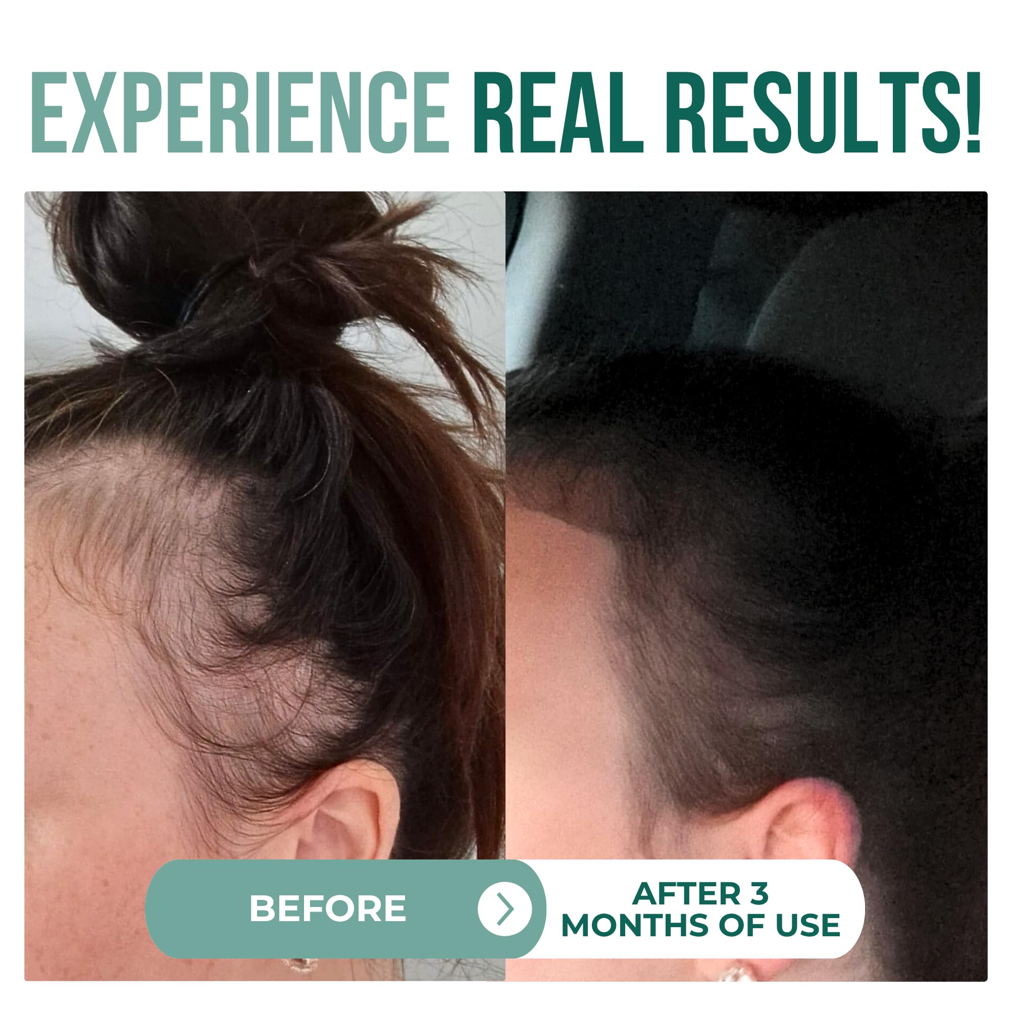 Vitamo Batana: aplicación en el cabello para brillo y nutrición.