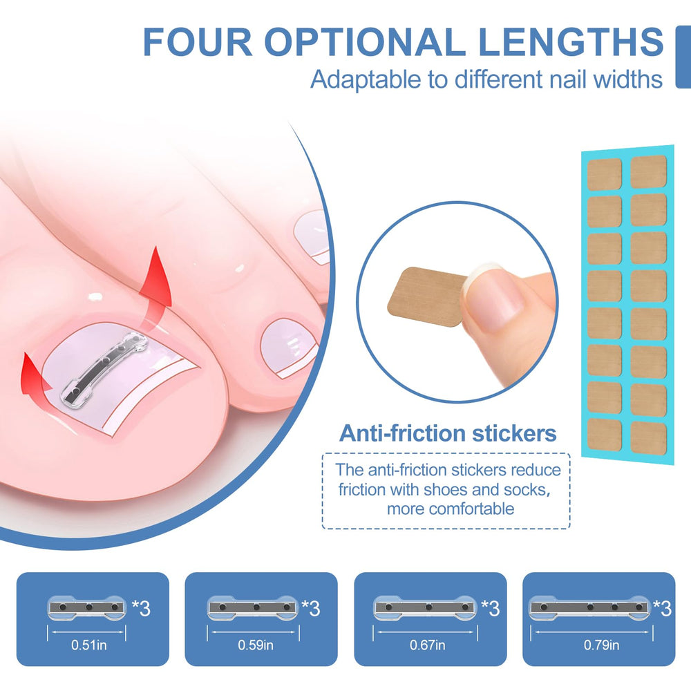 VITASY correcteur d’ongle incarné en action, solution pratique à domicile.