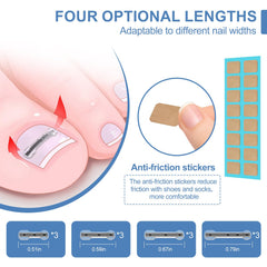 VITASY correcteur d’ongle incarné en action, solution pratique à domicile.