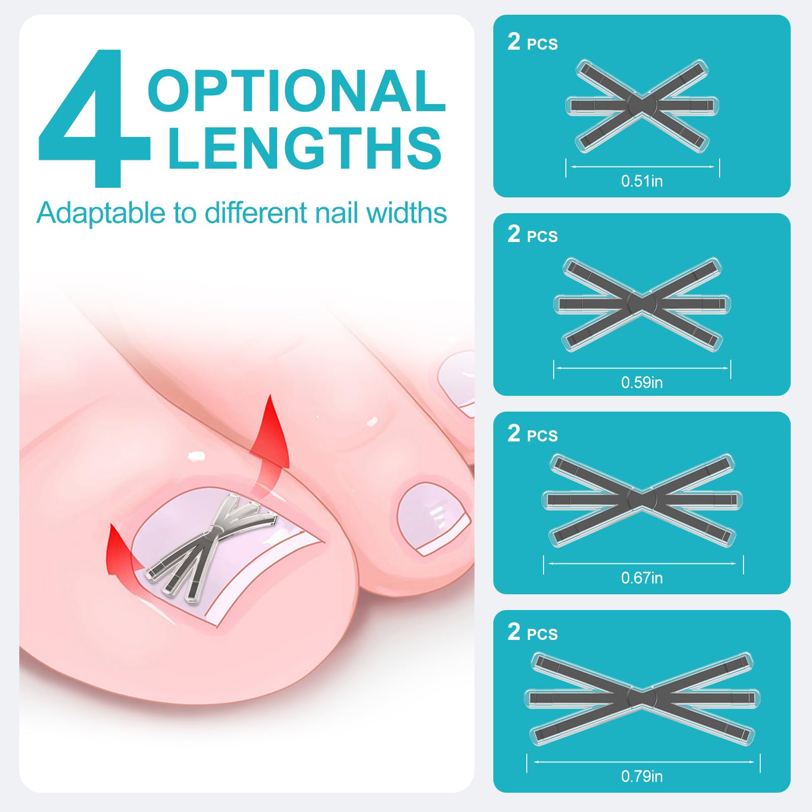 VITASY kit ongle incarné 4 tailles, ajuste facilement selon la largeur.