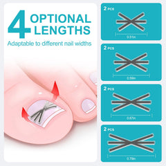 VITASY kit ongle incarné 4 tailles, ajuste facilement selon la largeur.