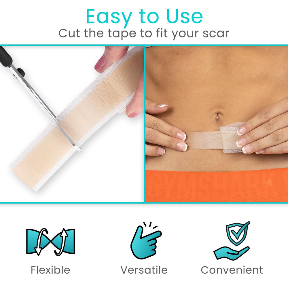 ViveCare: tira ajustable de silicona, recorta al tamaño exacto de la cicatriz.