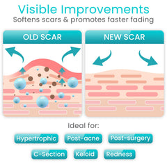 ViveCare: tira de silicona para cicatriz keloide, ayuda a gestionar su apariencia.