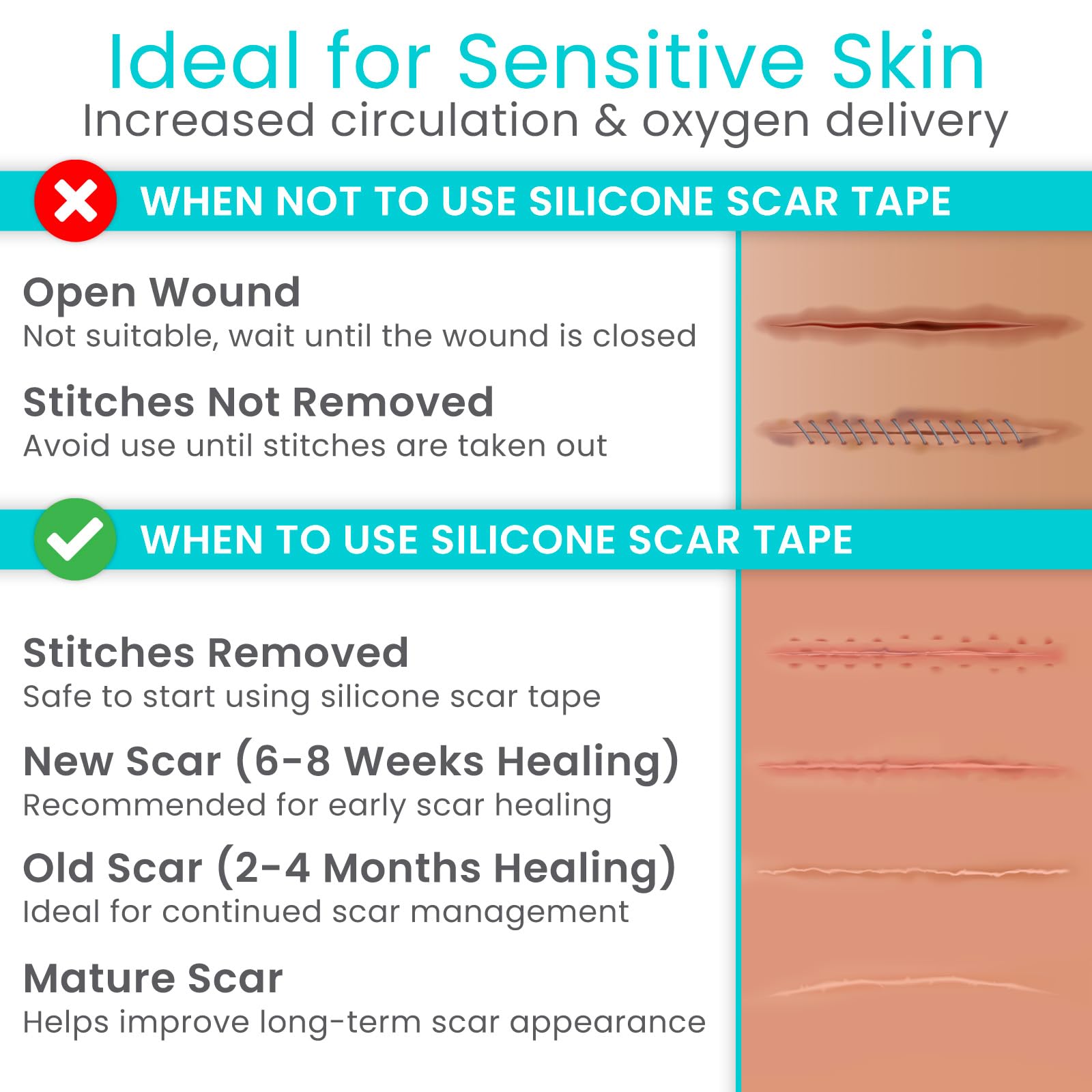 ViveCare: cinta de silicona reutilizable, lista para múltiples usos y cuidado sencillo.