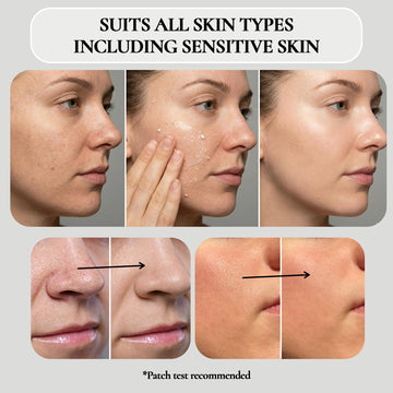 Vivo Per Lei Gel exfoliante enfoca puntos negros para limpieza suave