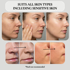 Vivo Per Lei Gel exfoliante enfoca puntos negros para limpieza suave