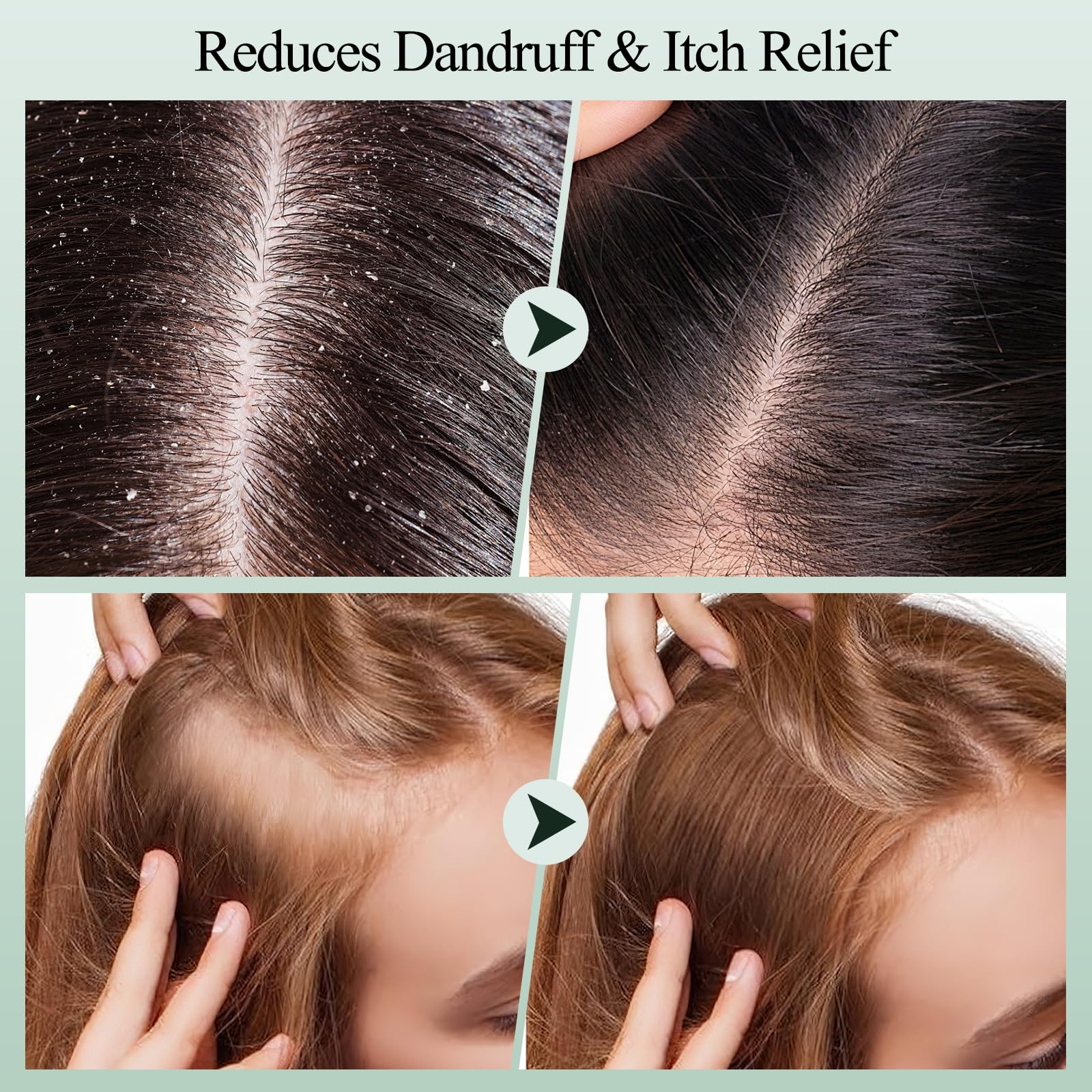 VOERUY aceite de jojoba hidrata y fortalece las raíces durante la exfoliación.