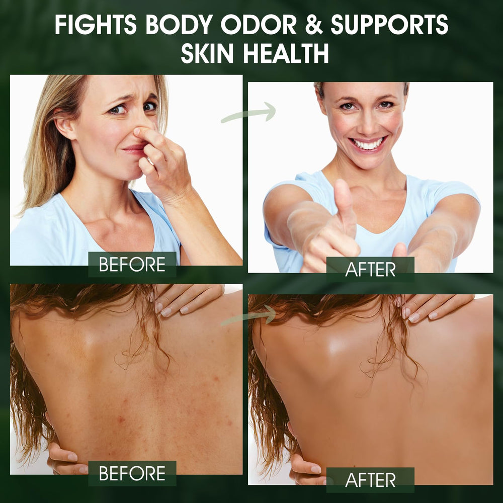 VOERUY gel ducha desodorante piel seca menos picor tras la ducha.