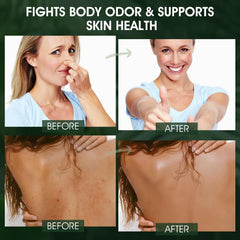 VOERUY gel ducha desodorante piel seca menos picor tras la ducha.