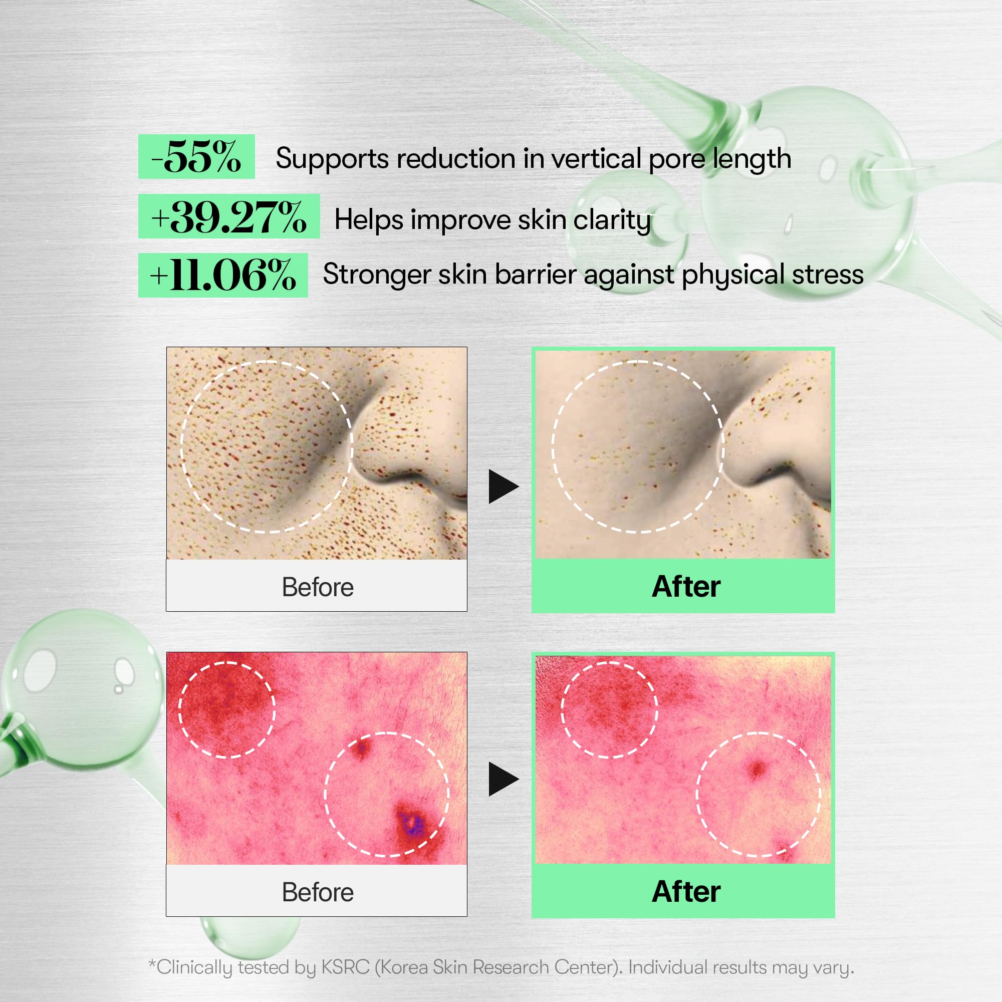 VT COSMETICS Reedle Shot 100: enfoque en poros visibles reducidos y piel más lisa