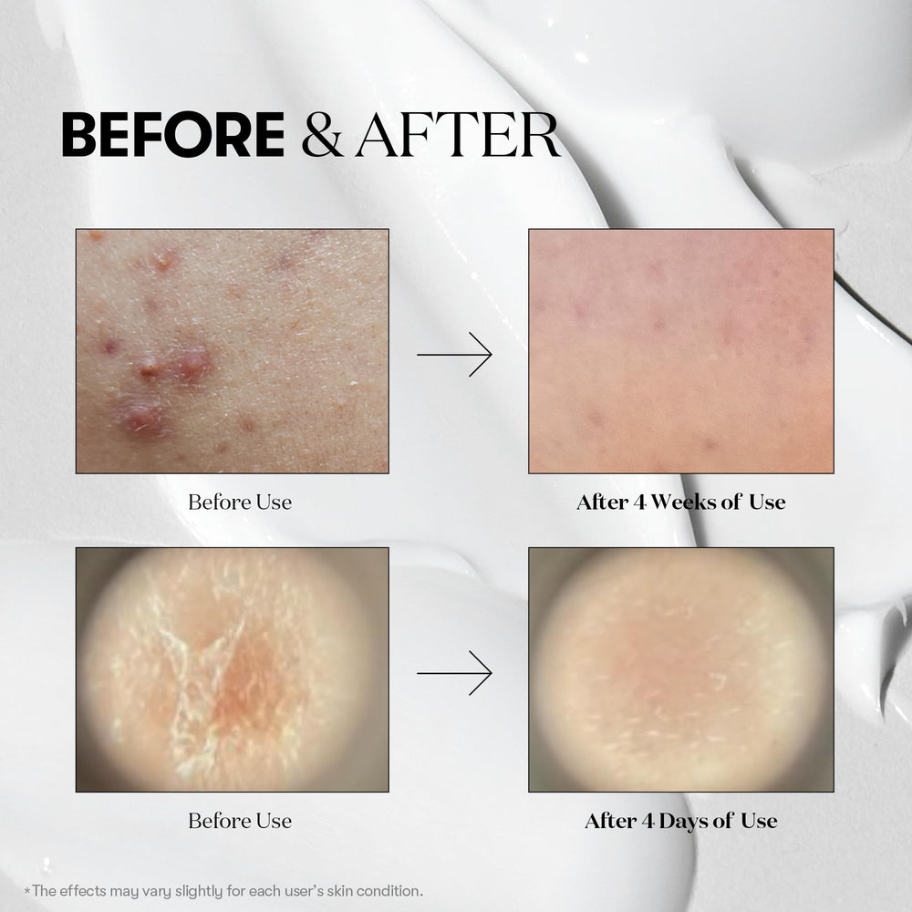 VT COSMETICS Reedle Shot 700 frasco para revitalizar la piel y su vitalidad.