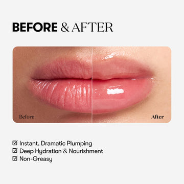 Ingrediente ácido hialurónico en Reedle Shot Lip Plumper para hidratación profundа