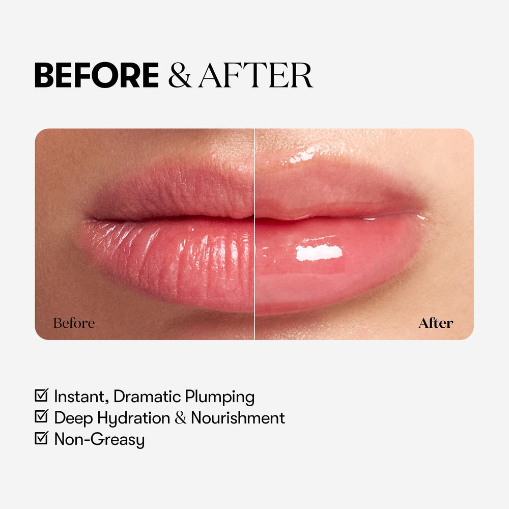 Ingrediente ácido hialurónico en Reedle Shot Lip Plumper para hidratación profundа