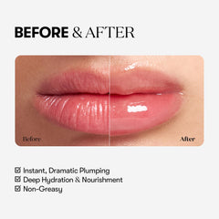 Ingrediente ácido hialurónico en Reedle Shot Lip Plumper para hidratación profundа