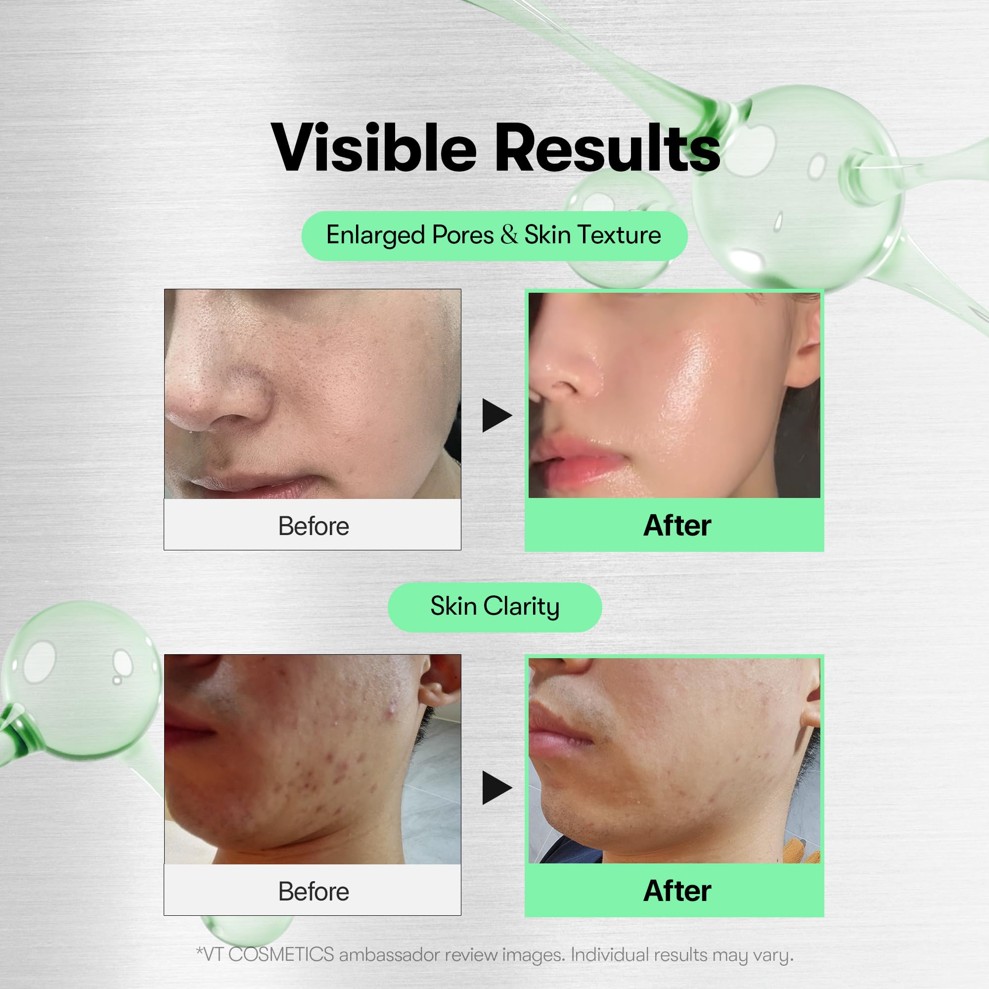 VT COSMETICS Reedle Shot – micro-aiguilles visibles aidant le renouvellement cutané.