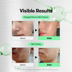 VT COSMETICS Reedle Shot – micro-aiguilles visibles aidant le renouvellement cutané.