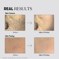 VT COSMETICS TX Toning Daily Mask aplicación ligera en la piel.