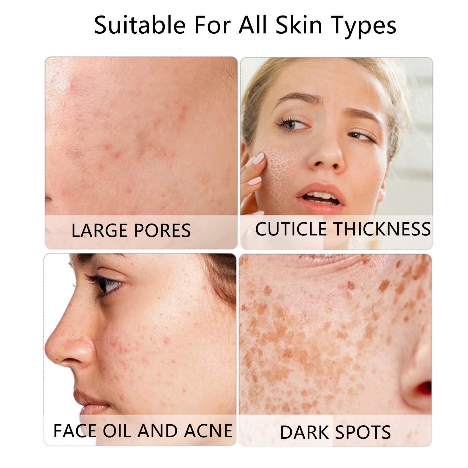 VWMYQ cepillo silicona cuadrado para exfoliar suavemente