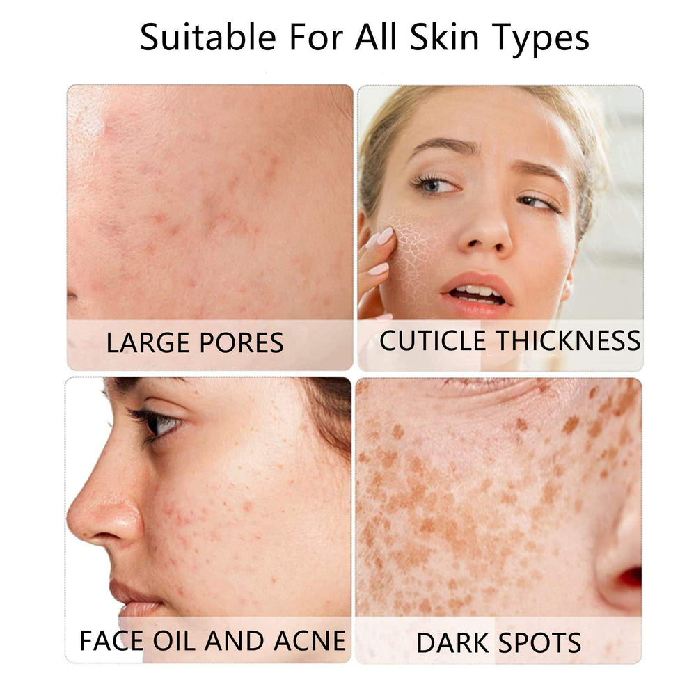 VWMYQ cepillo silicona cuadrado para exfoliar suavemente